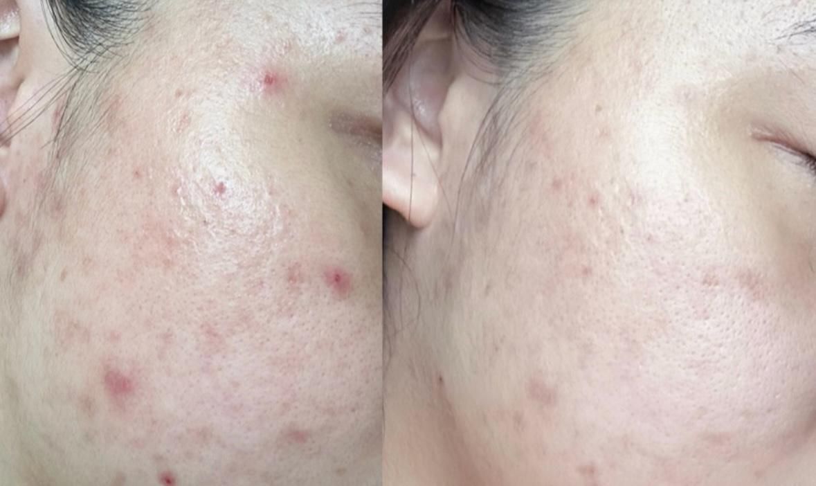 mae | Mae Clarity #清潔泥膜#100%天然植物萃取| HKTVmall 香港最大網購平台