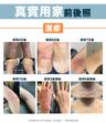 Cubed Relief Plus™ 低敏紓緩濕疹潤膚霜 / 濕疹膏 - 可有效舒緩濕疹和類固醇戒斷