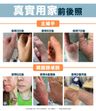 Cubed Relief Plus™ 低敏紓緩濕疹潤膚霜 / 濕疹膏 - 可有效舒緩濕疹和類固醇戒斷
