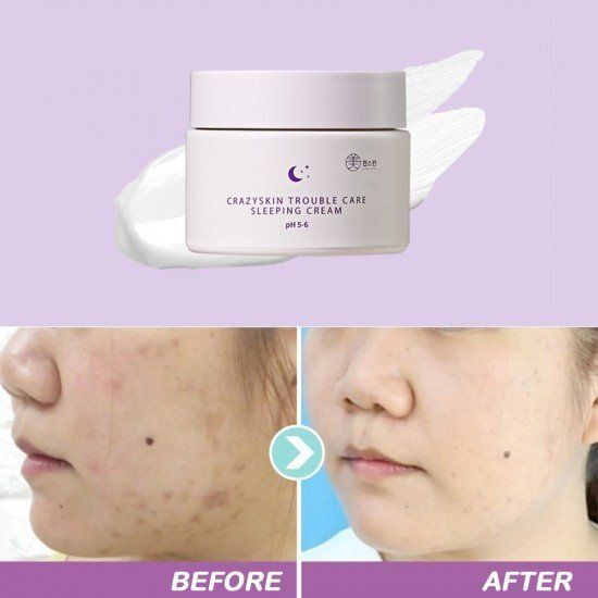 防敏鎮靜補濕霜 (UPGRADE)