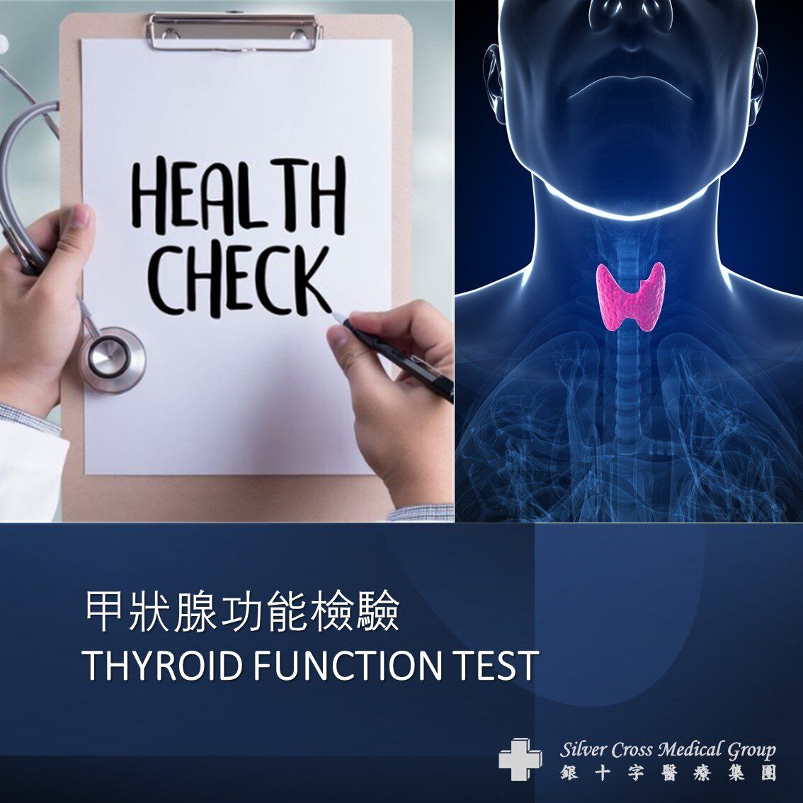 THYROID FUNCTION TEST (#TFT1) - 1 Session