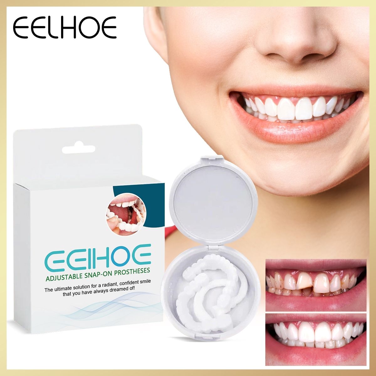 《一對裝》EELHOE 可調節仿真牙齒假牙套 卡扣式假牙牙套 假牙牙齒套裝 牙縫補齊牙套 老人仿真牙套 修飾斷牙齒牙套 填補牙縫牙洞套件 臨時補牙牙套 矯正牙齒假牙套裝 固體牙膠丨牙齒護理 護理用品